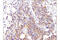 Induced myeloid leukemia cell differentiation protein Mcl-1 antibody, 39224S, Cell Signaling Technology, Immunohistochemistry paraffin image 