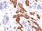 Mucin 1, Cell Surface Associated antibody, NBP2-48377, Novus Biologicals, Immunohistochemistry paraffin image 