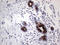 Anterior Gradient 2, Protein Disulphide Isomerase Family Member antibody, LS-C795126, Lifespan Biosciences, Immunohistochemistry paraffin image 