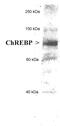 MLX Interacting Protein Like antibody, ab92809, Abcam, Western Blot image 
