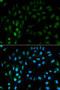 Tissue Factor Pathway Inhibitor antibody, STJ25826, St John