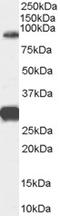 Forkhead Box P2 antibody, STJ71049, St John