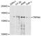 Transient Receptor Potential Cation Channel Subfamily M Member 4 antibody, abx136056, Abbexa, Western Blot image 