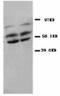 Protein Phosphatase 2 Catalytic Subunit Alpha antibody, LS-C171830, Lifespan Biosciences, Western Blot image 