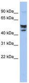 Serine Incorporator 2 antibody, TA333416, Origene, Western Blot image 