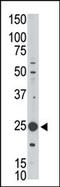 MAGE Family Member H1 antibody, MBS9204012, MyBioSource, Western Blot image 