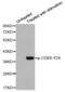 Cyclin Dependent Kinase 6 antibody, LS-C335940, Lifespan Biosciences, Western Blot image 