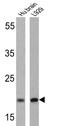 Presenilin 2 antibody, GTX15549, GeneTex, Western Blot image 