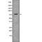 Rho guanine nucleotide exchange factor 4 antibody, abx148329, Abbexa, Western Blot image 