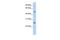 Chymotrypsin-like protease CTRL-1 antibody, GTX47741, GeneTex, Western Blot image 