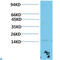 Transthyretin antibody, LS-C813255, Lifespan Biosciences, Western Blot image 