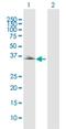 PDZ And LIM Domain 2 antibody, H00064236-D01P, Novus Biologicals, Western Blot image 