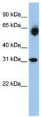 Dehydrogenase/Reductase 2 antibody, TA346419, Origene, Western Blot image 