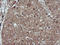 Mitogen-Activated Protein Kinase Kinase 1 antibody, LS-C174379, Lifespan Biosciences, Immunohistochemistry paraffin image 