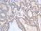 Activin A Receptor Type 1C antibody, LS-C401164, Lifespan Biosciences, Immunohistochemistry frozen image 