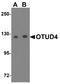 OTU Deubiquitinase 4 antibody, A07830, Boster Biological Technology, Western Blot image 