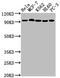 DNA Topoisomerase I antibody, CSB-RA792129A0HU, Cusabio, Western Blot image 