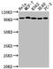 DNA Topoisomerase I antibody, CSB-RA792129A0HU, Cusabio, Western Blot image 