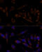 Transferrin Receptor antibody, 19-906, ProSci, Immunofluorescence image 