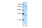 AU RNA Binding Methylglutaconyl-CoA Hydratase antibody, 29-277, ProSci, Enzyme Linked Immunosorbent Assay image 