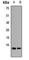 Tax1 Binding Protein 3 antibody, LS-C668503, Lifespan Biosciences, Western Blot image 