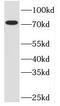 TBC1 Domain Family Member 17 antibody, FNab08510, FineTest, Western Blot image 