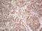 Protein Phosphatase 1 Catalytic Subunit Alpha antibody, NBP2-45384, Novus Biologicals, Immunohistochemistry paraffin image 