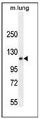 PHD Finger Protein 12 antibody, AP53280PU-N, Origene, Western Blot image 