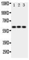 Hexosaminidase Subunit Alpha antibody, PA1787, Boster Biological Technology, Western Blot image 