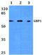 Interferon-induced guanylate-binding protein 1 antibody, A03067, Boster Biological Technology, Western Blot image 