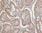 Catechol-O-Methyltransferase antibody, M00464, Boster Biological Technology, Immunohistochemistry frozen image 