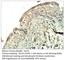 Sec23 Homolog A, Coat Complex II Component antibody, SEC23-101AP, FabGennix, Immunohistochemistry paraffin image 