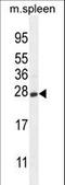 Crystallin Gamma S antibody, LS-C167070, Lifespan Biosciences, Western Blot image 