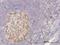 Cyclin Dependent Kinase 1 antibody, H00000983-M04, Novus Biologicals, Immunohistochemistry frozen image 