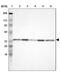 Cytochrome B5 Reductase 3 antibody, NBP1-84252, Novus Biologicals, Western Blot image 