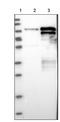 TOX high mobility group box family member 4 antibody, NBP1-88433, Novus Biologicals, Western Blot image 