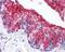 Mucin 1, Cell Surface Associated antibody, 48-570, ProSci, Immunohistochemistry paraffin image 