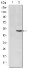 Methylenetetrahydrofolate Reductase antibody, STJ98257, St John