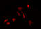 Adrenoceptor Beta 2 antibody, GTX02869, GeneTex, Immunofluorescence image 
