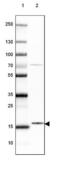 GSK3-beta interaction protein antibody, NBP2-30378, Novus Biologicals, Western Blot image 