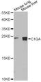 C1QA antibody, STJ26180, St John