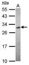 ChaC Glutathione Specific Gamma-Glutamylcyclotransferase 1 antibody, PA5-31762, Invitrogen Antibodies, Western Blot image 