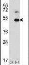 Thyroid Hormone Receptor Interactor 13 antibody, PA5-12461, Invitrogen Antibodies, Western Blot image 
