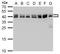 SET Nuclear Proto-Oncogene antibody, GTX113834, GeneTex, Western Blot image 
