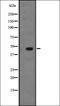 Interferon Induced Protein With Tetratricopeptide Repeats 1B antibody, orb337772, Biorbyt, Western Blot image 