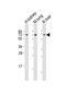 Acyl-CoA Synthetase Family Member 2 antibody, PA5-49471, Invitrogen Antibodies, Western Blot image 