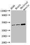 Transmembrane Protein 43 antibody, LS-C679831, Lifespan Biosciences, Western Blot image 