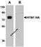 Seasonal H1N1 Hemagglutinin antibody, orb75888, Biorbyt, Western Blot image 