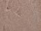 Glycogen Synthase Kinase 3 Alpha antibody, A03152Y279, Boster Biological Technology, Immunohistochemistry frozen image 