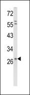 Syndecan 1 antibody, LS-C168513, Lifespan Biosciences, Western Blot image 